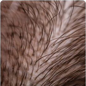 Activa tu cabello desde la raíz